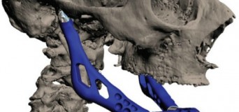 Huesos hechos en impresoras 3D